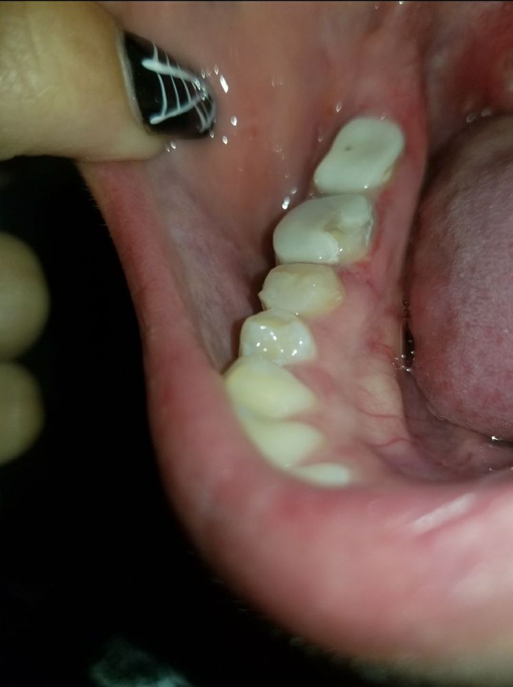 AMERICAN DENTAL GROUP 36 Photos & 71 Reviews 436 N Sunset Ave, West