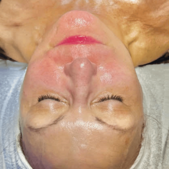 Catara Med Spa - Catara Med Spa Facial massage technique combined with professional facials for women seeking skin relaxation and circulation support - Medical Spas Near Me - Algonquin, Illinois