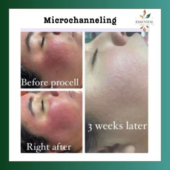 Essential  - Permanent Makeup Near Me - Land O' Lakes, Florida