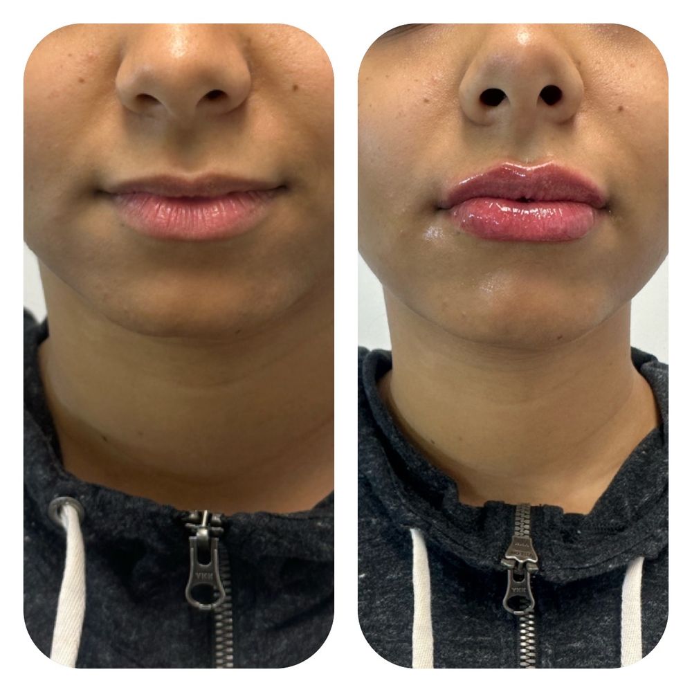 Advanced Skin Renewal Logo