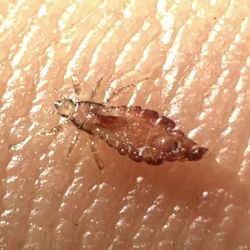 Nits N Lice Care Clinics