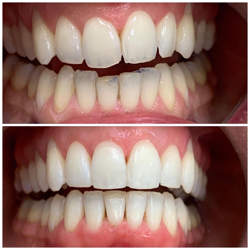 LINCOLN SQUARE DENTAL Updated September 2024 45 Reviews 4147 N