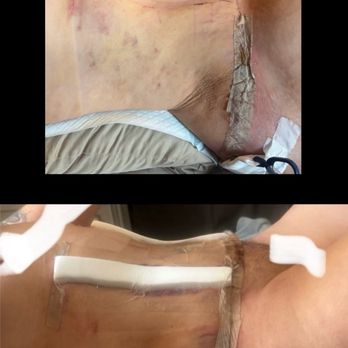 Mi Casa Day Spa - Post surgical lymphatic drainage - Massage Near Me