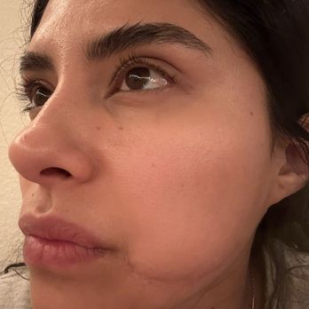 Mika Beauty And Brows - One week after 2nd appointment - Permanent Makeup Near Me - San Diego, California Mika Beauty And Brows - One week after 2nd appointment - Permanent Makeup Near Me - San Diego, California