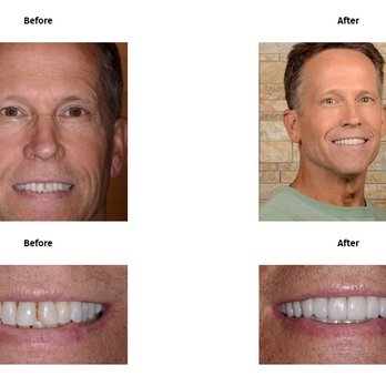 Artistry In Dentistry - General Dentistry Near Me - Gilbert, Arizona Artistry In Dentistry - General Dentistry Near Me - Gilbert, Arizona