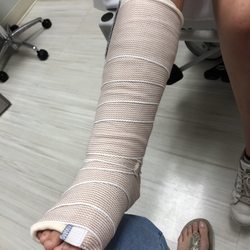 Premier ER & Urgent Care - Waco - The beautiful splint that we walked out with.