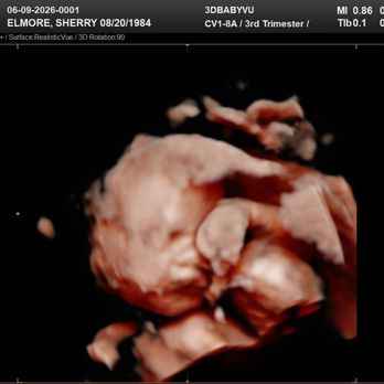 3DBabyVu - Ultrasound Imaging Centers Near Me - Pleasanton, California 3DBabyVu - Ultrasound Imaging Centers Near Me - Pleasanton, California