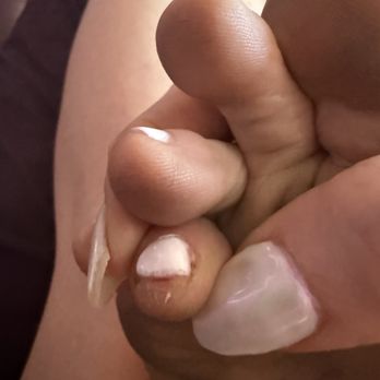 Nail Spa Excel - Injury - Nail Salons Near Me - Las Vegas, Nevada
