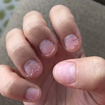 Rose Nails - nail tech ripped my acrylics off instead of soaking them off. told me soaking them is damaging. this isn't damaging though? - Nail Salons Near Me - Cape Coral, Florida