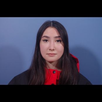 Jan Zemplenyi, MD - After non surgical rhinoplasty front profile - Cosmetic Surgeons Near Me - Bellevue, Washington Jan Zemplenyi, MD - After non surgical rhinoplasty front profile - Cosmetic Surgeons Near Me - Bellevue, Washington