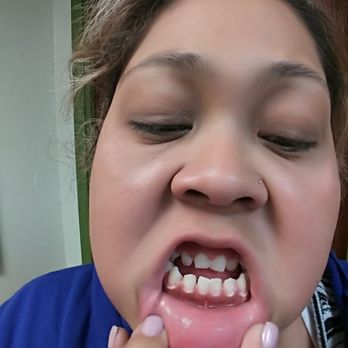 Melind Do DDS - General Dentistry Near Me - Anaheim, California Melind Do DDS - General Dentistry Near Me - Anaheim, California