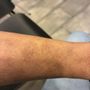 Photo of TruDerm