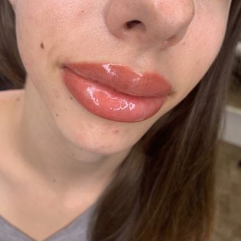 Beauty By Janice - Lip blush right after procedure - Permanent Makeup Near Me - Temple City, California Beauty By Janice - Lip blush right after procedure - Permanent Makeup Near Me - Temple City, California