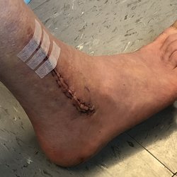 Matthew W Tetreault, MD