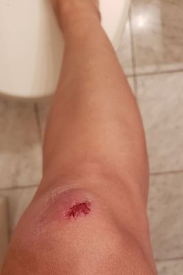 Dimes Market by null