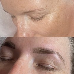 SB Skincentives