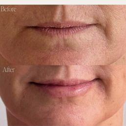 Before and after