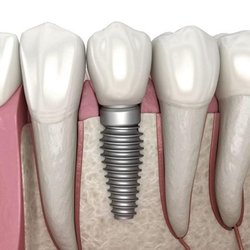 Peter Smilovits, DDS