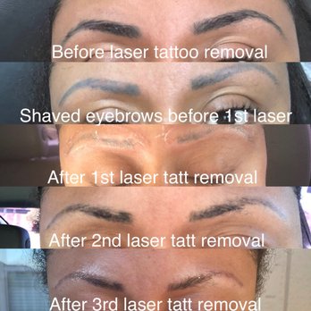 Let's Face It - Permanent Makeup Near Me - Kansas City, Missouri