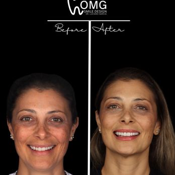OMG Smile Design - Cosmetic Dentists Near Me - Deerfield Beach, Florida OMG Smile Design - Cosmetic Dentists Near Me - Deerfield Beach, Florida