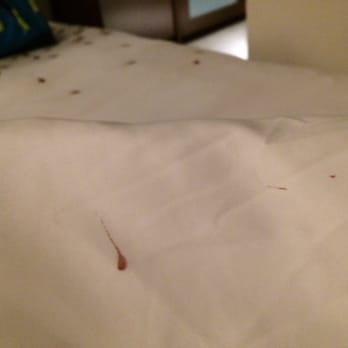 Renaissance Seattle Hotel - Returned home today to bedsheets with blood stains. - Hotels Near Me - Seattle, Washington Renaissance Seattle Hotel - Returned home today to bedsheets with blood stains. - Hotels Near Me - Seattle, Washington