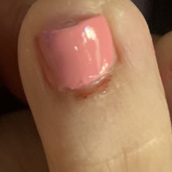 Le Nails - Cut her toe and bled - Nail Salons Near Me - Aiea, Hawaii