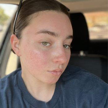 1. JL and Skin