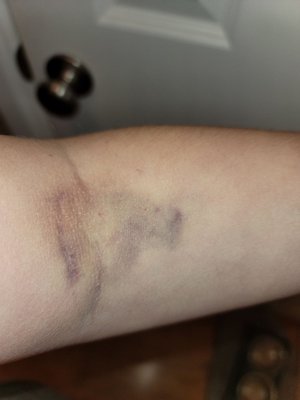 BIOLIFE PLASMA SERVICES - Updated March 2025 - 15 Photos & 45 Reviews ...