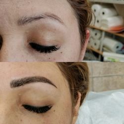 Brow
