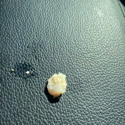 McDonald's - There was very large tooth in my sisters chicken nugget