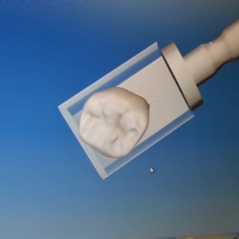 Posh Dental - Dawnie will 3d scan your mouth with a wand several times, create a 3d model, and the resultant crown is floss perfect! - General Dentistry Near Me - Chandler, Arizona