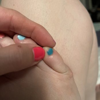 Nu Image Nails Spa - Same as other pics, caked on and onto my skin - Hair Removal Near Me - Chicago, Illinois