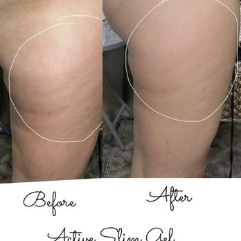 Lavande Face & Body - Active slim gel to minimize cellulite!
After one application
#slim#tone#cleanbeauty - Skin Care Near Me - Plano, Texas Lavande Face & Body - Active slim gel to minimize cellulite!
After one application
#slim#tone#cleanbeauty - Skin Care Near Me - Plano, Texas