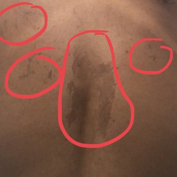 The Thread Loft - My back - Eyebrow Services Near Me - New York, New York