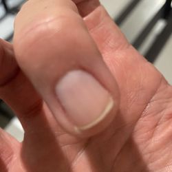 Baraboo Nail Spa - Bleeding nail beds - dry nipping