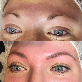 KD Skin - Skin Care Near Me