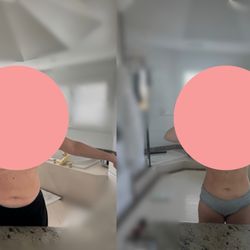 Before / after body sculpt