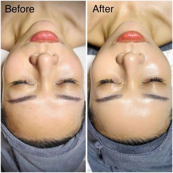 EverTrue Medical Spa - Skin Care Near Me - Fountain Valley, California