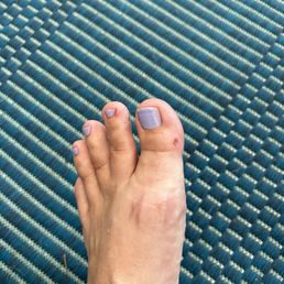 Villa nail salon, injured foot from pedicure Villa nail salon, injured foot from pedicure