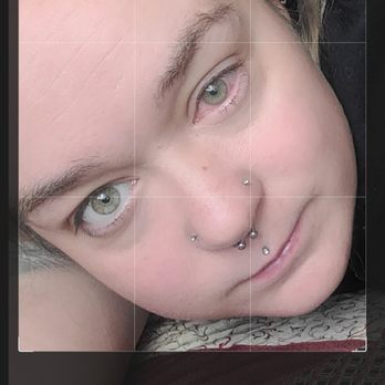Eye and Wellness - This is a mirror image selfie of the same eye, you can tell by the freckle on the right side of my nose. Insisted its an irritated left eye - Optometrists Near Me - Pullman, Washington