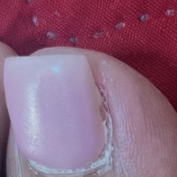 Nail quality Nail quality