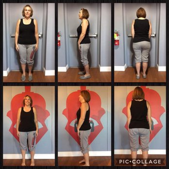 Temeculas Weight Loss Transformation - Progress Pics - Weight Loss Centers Near Me - Temecula, California Temeculas Weight Loss Transformation - Progress Pics - Weight Loss Centers Near Me - Temecula, California