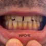 Premium Dental