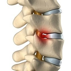 Berman Chiropractic