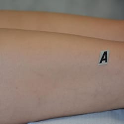 Vein Clinic of Southern California