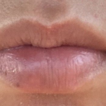 Glow Eyesthetics - Before procedure  Grumpy lips - Eyelash Service Near Me - Huntington Beach, California