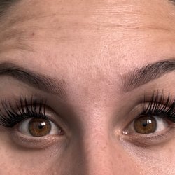 After receiving botox in my forehead and crows feet, there is ZERO improvement.