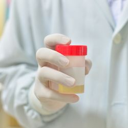 HD Screening and Laboratory