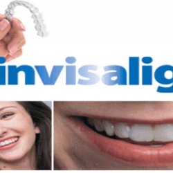 Daniel H Lipnik, DDS - Family and Cosmetic Dentistry - Invisalign braces Livonia MI