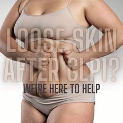Lake County Plastic Surgery - Curious about your options after weight loss? Loose skin removal is our specialty! For a consultation, text : 847.429.3597